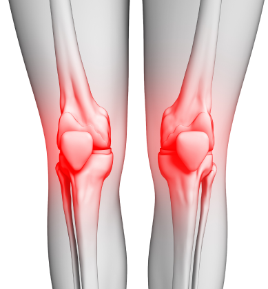 Osteoarthritis